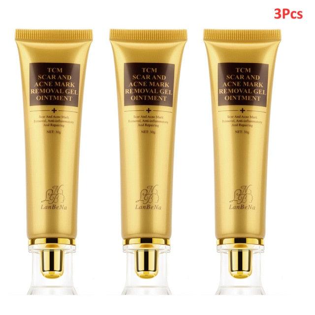 Stretch Marks Remove Acne Scar Treatment Cream Face Whitening Cream Pimple (M1)(1U86)