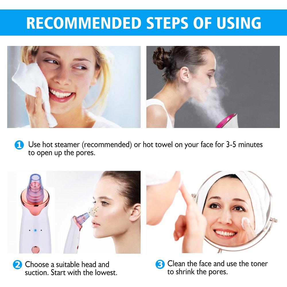 Blackhead Remover Facial Nose Cleaner T Zone Deep Pore Acne Pimple Removal Vacuum Suction (M5)(M1)(1U86)