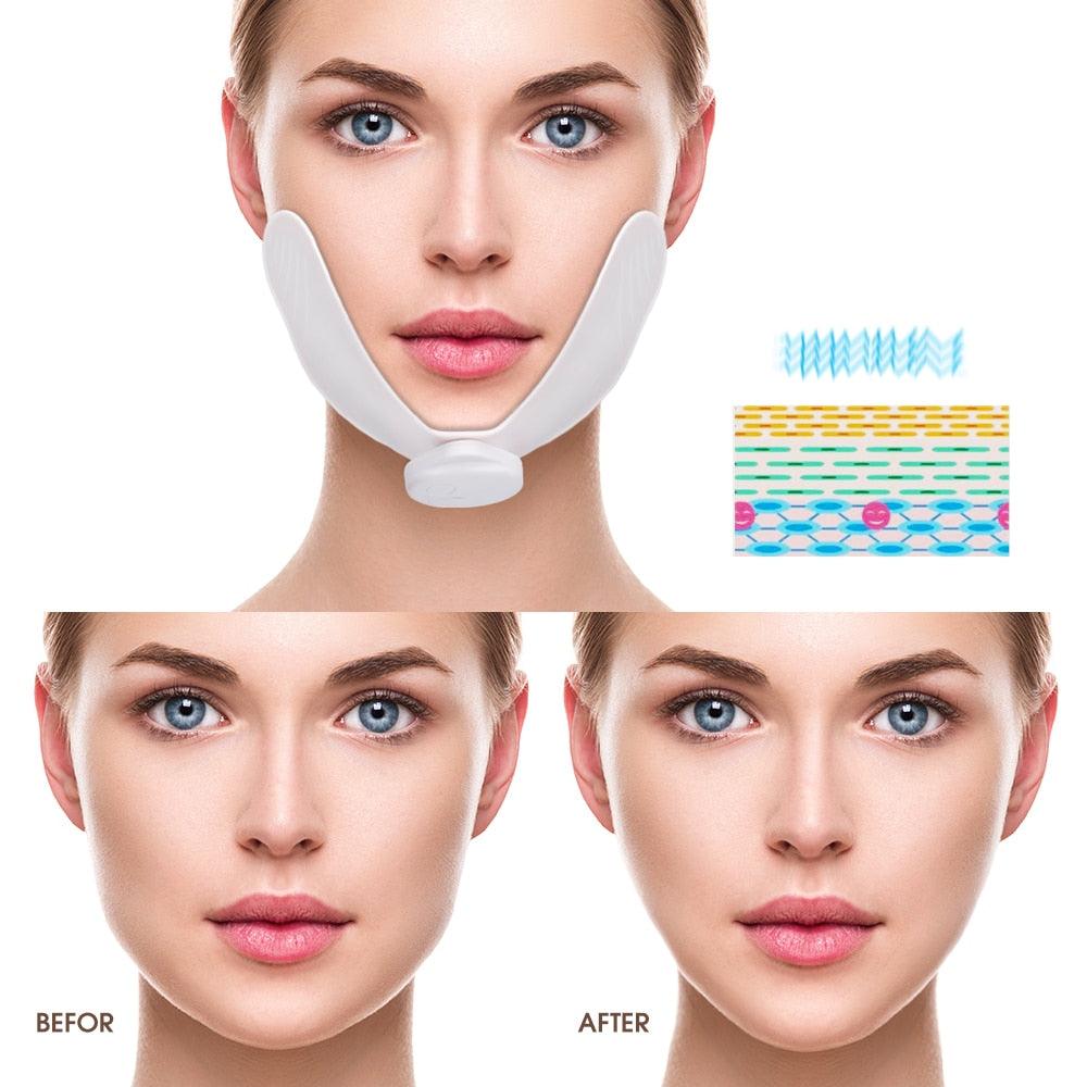 EMS Face Lifting Massager Electronic Pulse Muscle Stimulator V Face Slimming Exerciser(M5)(M1)(1U86)