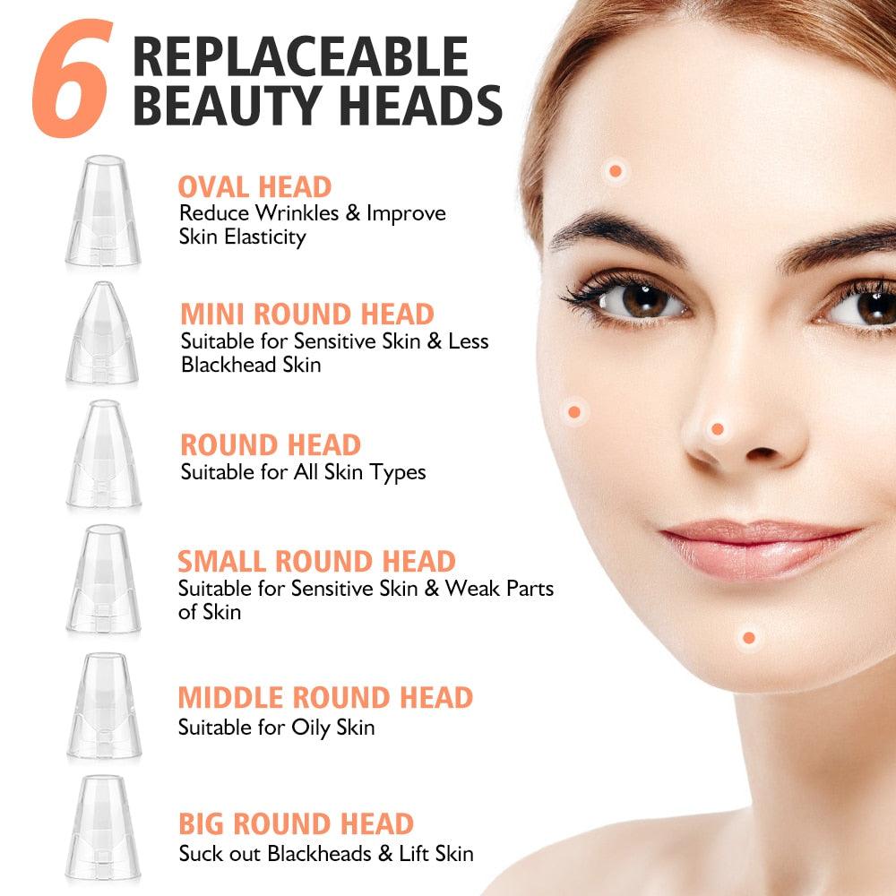 Electric Blackhead Remover Vacuum Suction Face Deep Pore Cleaner Pimple Acne Extractor (M5)(M1)(1U86)