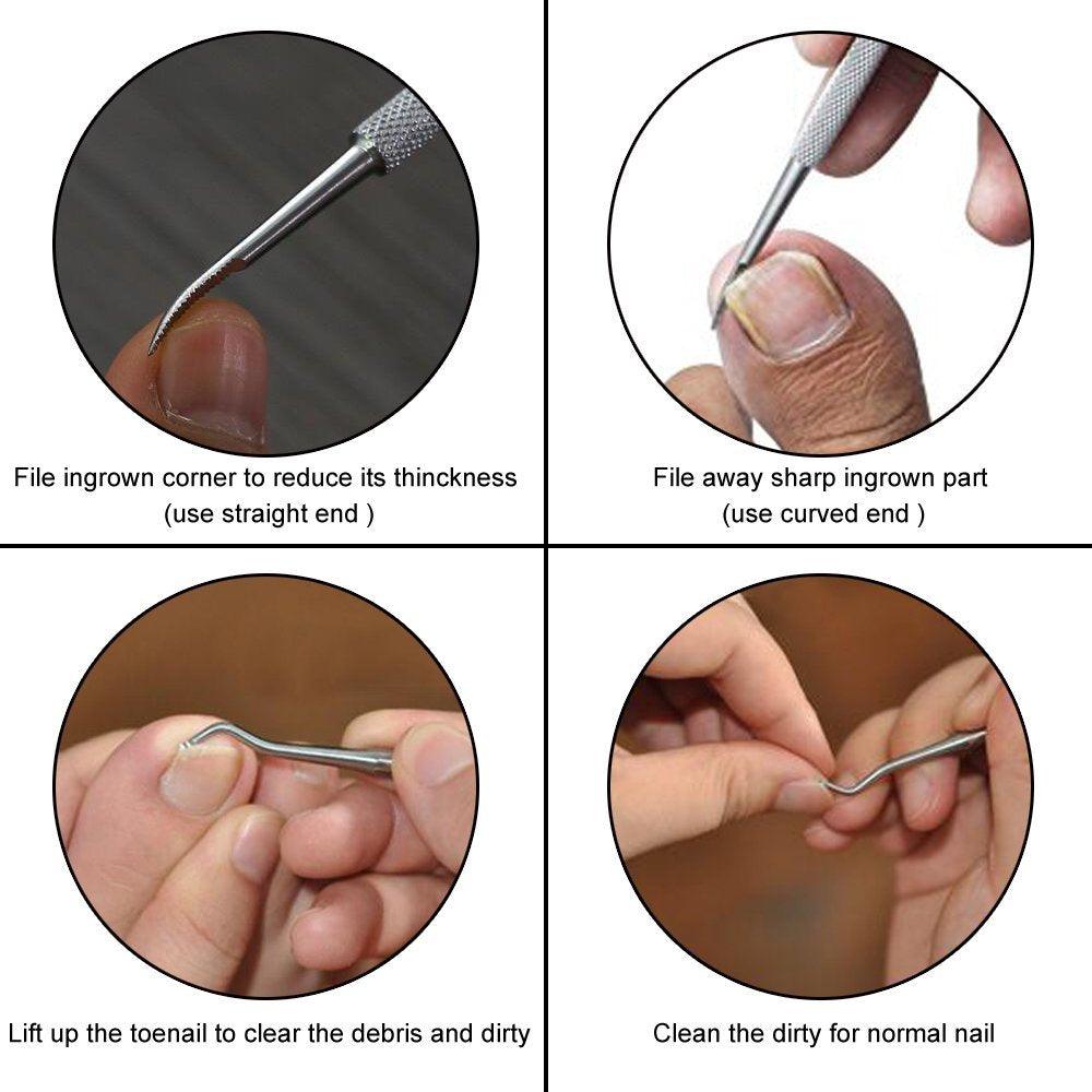 Ingrown Toenail File and Lifter Double Sided Stainless Steel Professional Foot Nail Care Hook Pedicure (N3)