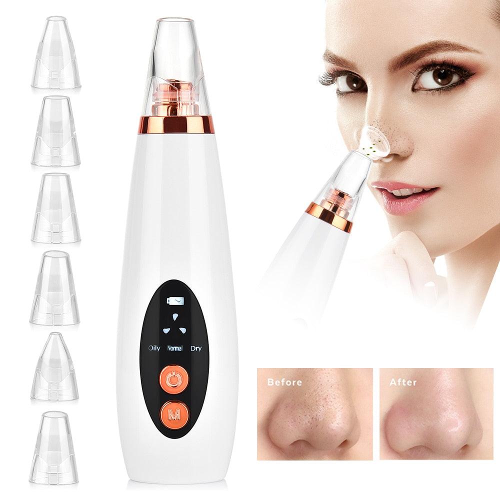 Facial Pore Cleaner Blackhead Remover Vacuum Suction Cleaner Pore Acne Pimple Extractor Device (M5)(1U86)