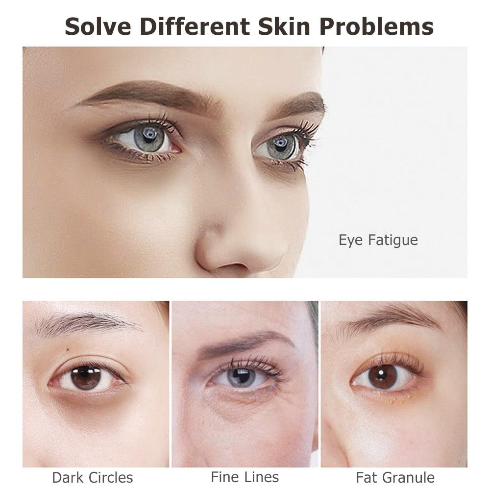 Gold Caviar Massager Eye Cream 2 in 1 Anti Wrinkle Eye Serum Roller Massager Anti Puffiness Remove Eye Dark Circles Eye Care(M2)(1U86)(F86)