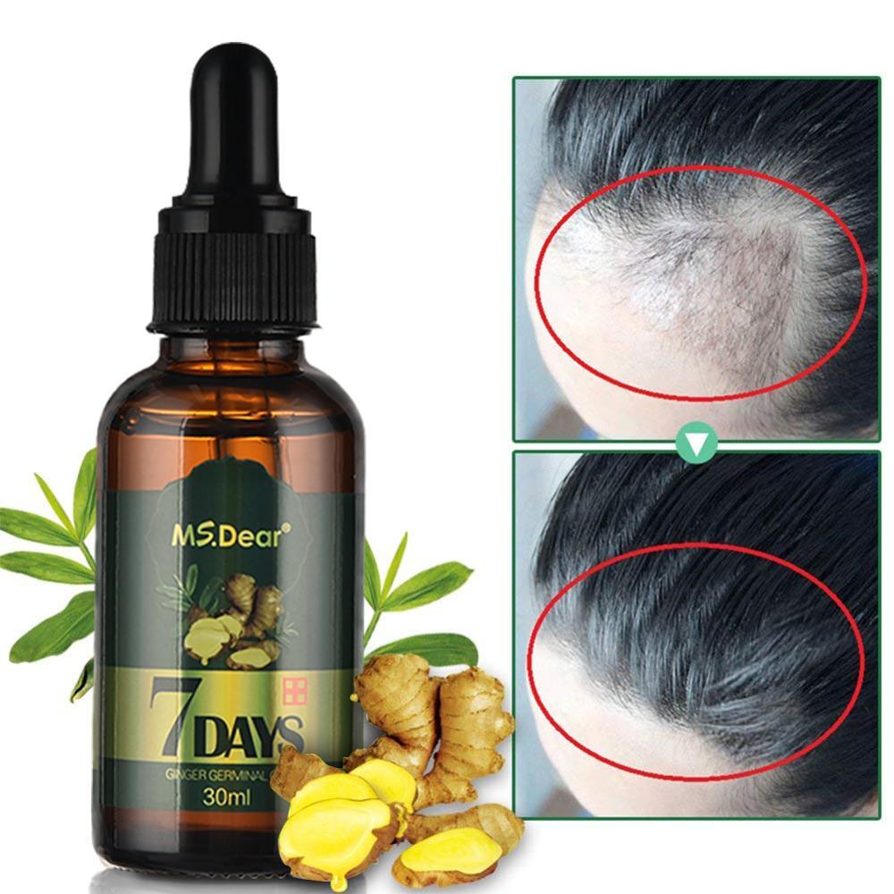 Hair Growth Essential Oils Ginger Germinal Oil Fast Hair Growth (BD5)(1U45)