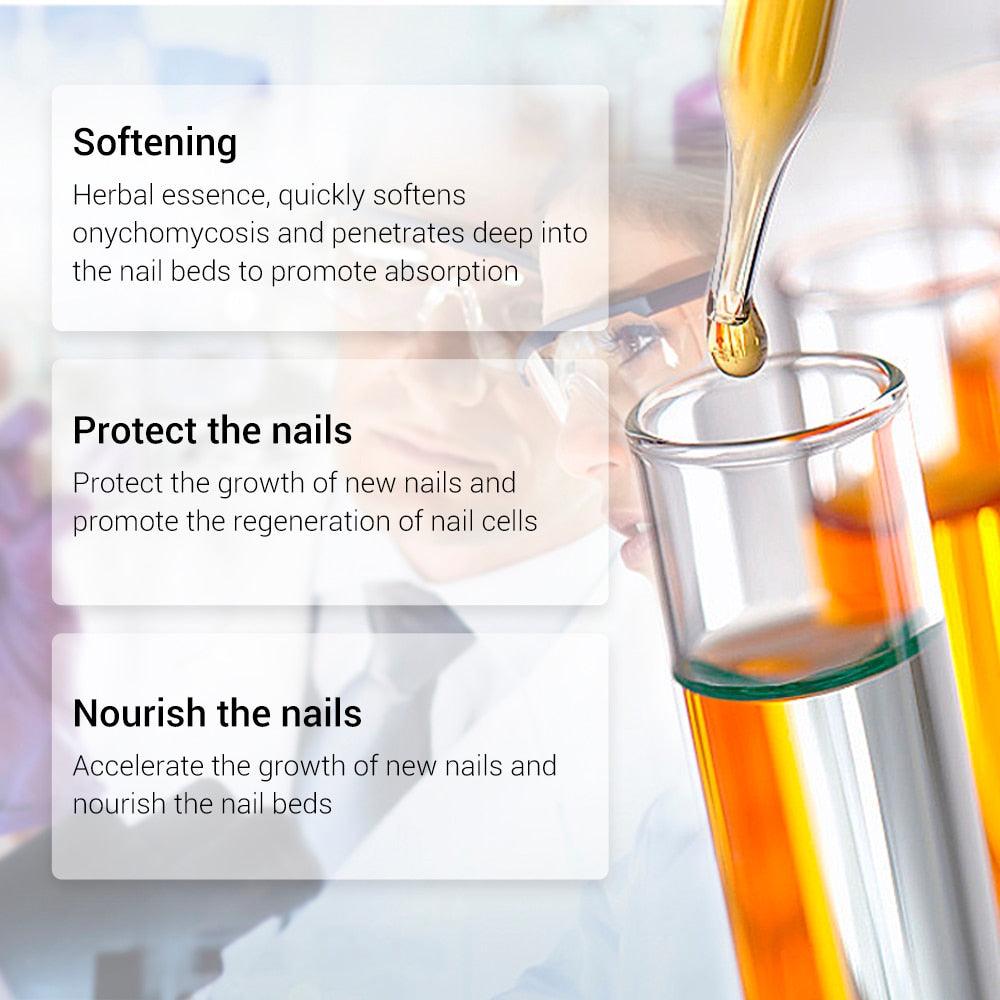 Nail Repair Essence Serum Care Treatment Foot Nail Fungus Removal Gel Anti Infection (N6)(1U85)