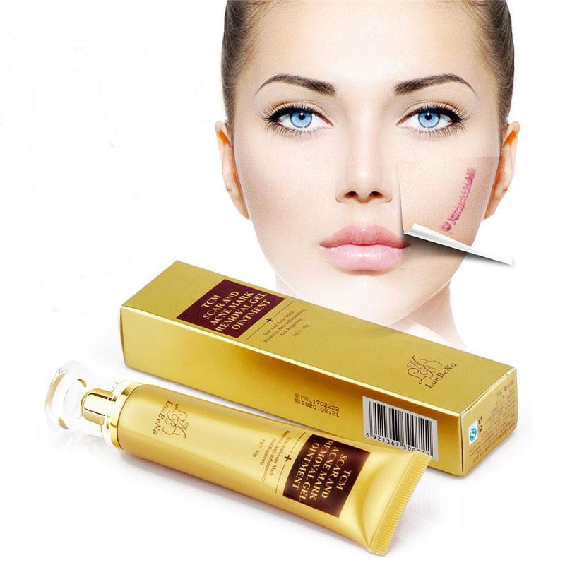 Stretch Marks Remove Acne Scar Treatment Whitening Cream Pimple Scar Pregnancy Nourish Skin Care (M1)(1U86)