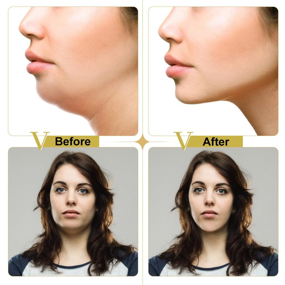 V Shape Lifting Facial Mask Chin Cheek Lift Ear Hanging Hydrogel Neck Facial Slimmling Bandage Mask (D86)(M1)