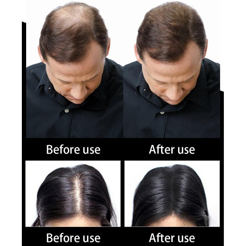 1000g Cosmetic Madeup Human Hair Fiber Hair Loss Concealer Styling Dye Color Fiber Hair Powder Applicator Refill Bag (BD1)(1U45)(F45)