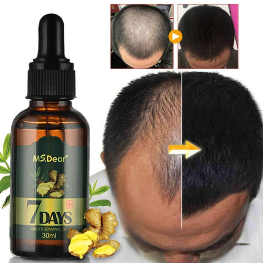 30ml Hair Growth Serum Ginger Hair Growth Essential Oil Anti Preventing Hair Loss (BD5)(1U45)