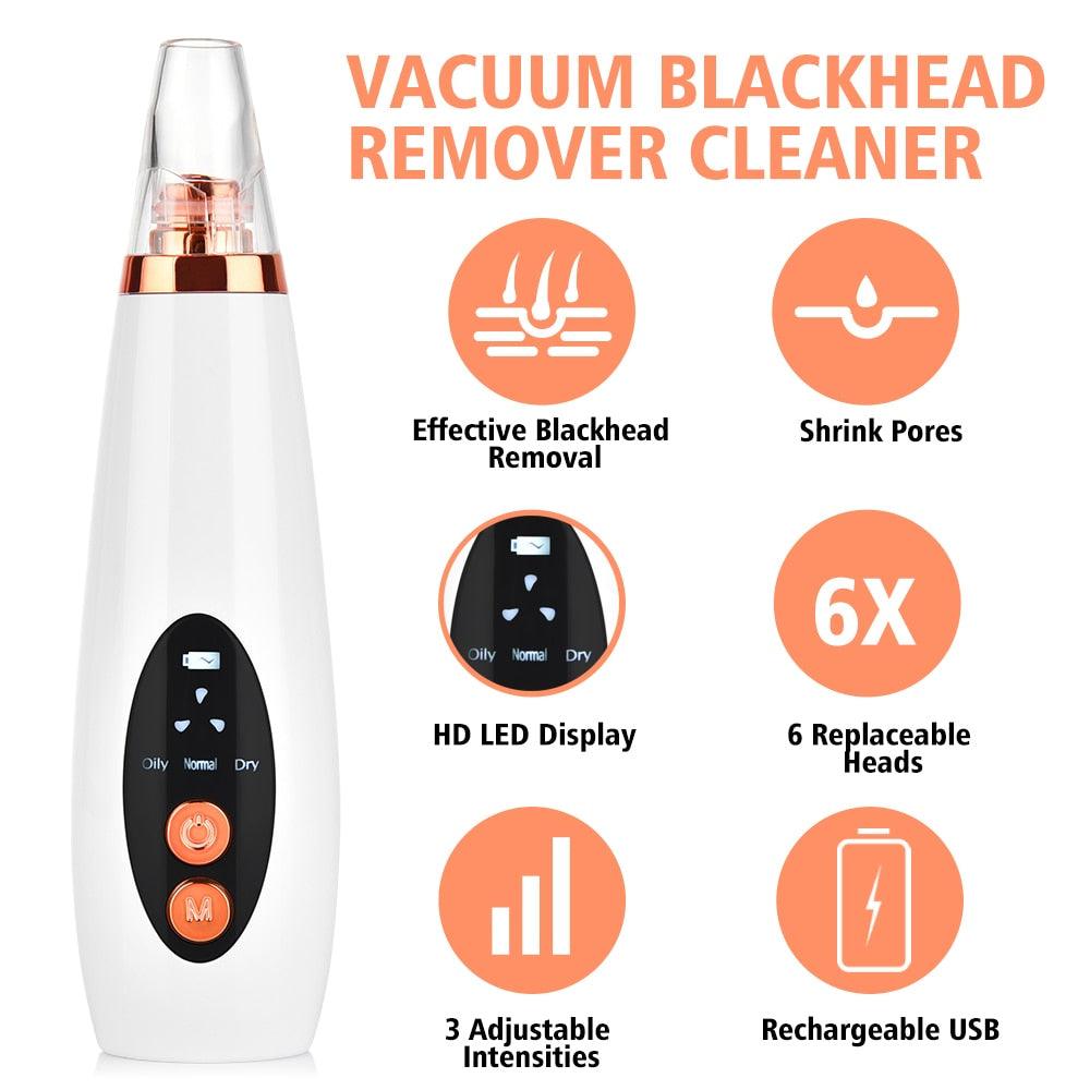 Electric Blackhead Remover Vacuum Suction Face Deep Pore Cleaner Pimple Acne Extractor (M5)(M1)(1U86)