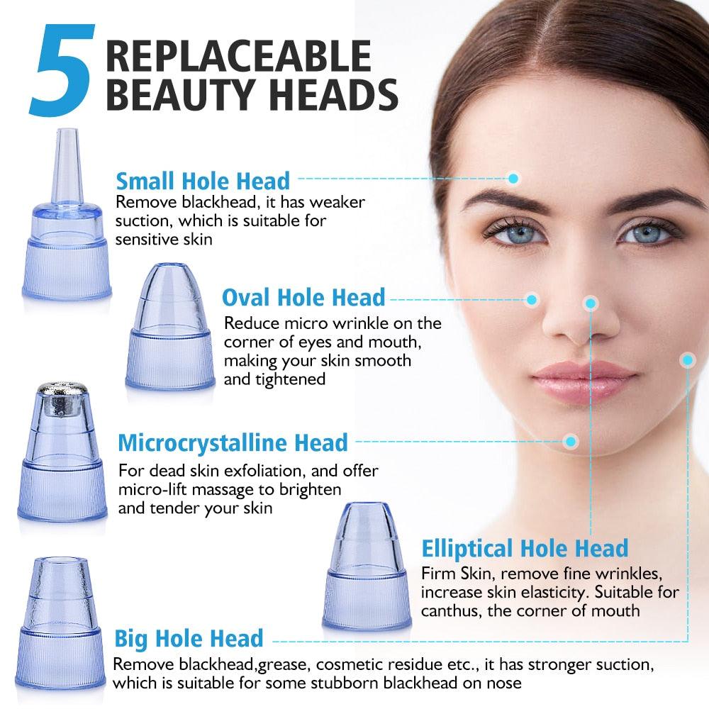 Facial Blackhead Remover Dead Skin Acne Pore Peeling Device Cleaning Skin Tool Vacuum Suck Out Blackhead (M5)(1U86)