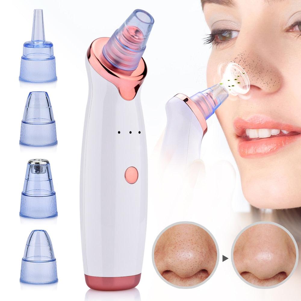 Facial Blackhead Remover Dead Skin Acne Pore Peeling Device Cleaning Skin Tool Vacuum Suck Out Blackhead (M5)(1U86)