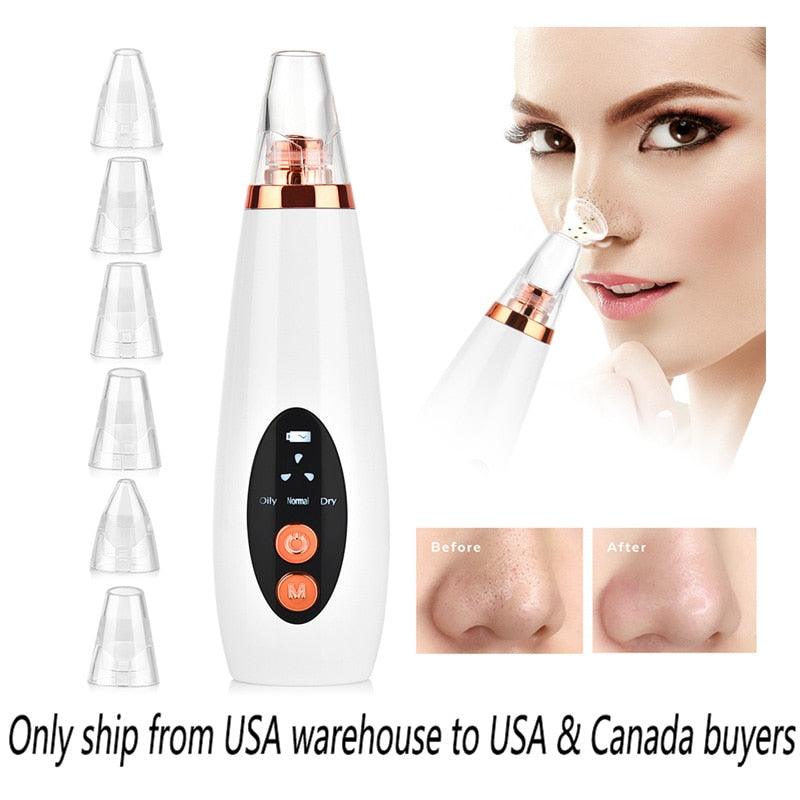 Facial Pore Cleaner Blackhead Remover Vacuum Suction Cleaner Pore Acne Pimple Extractor Device (M5)(1U86)