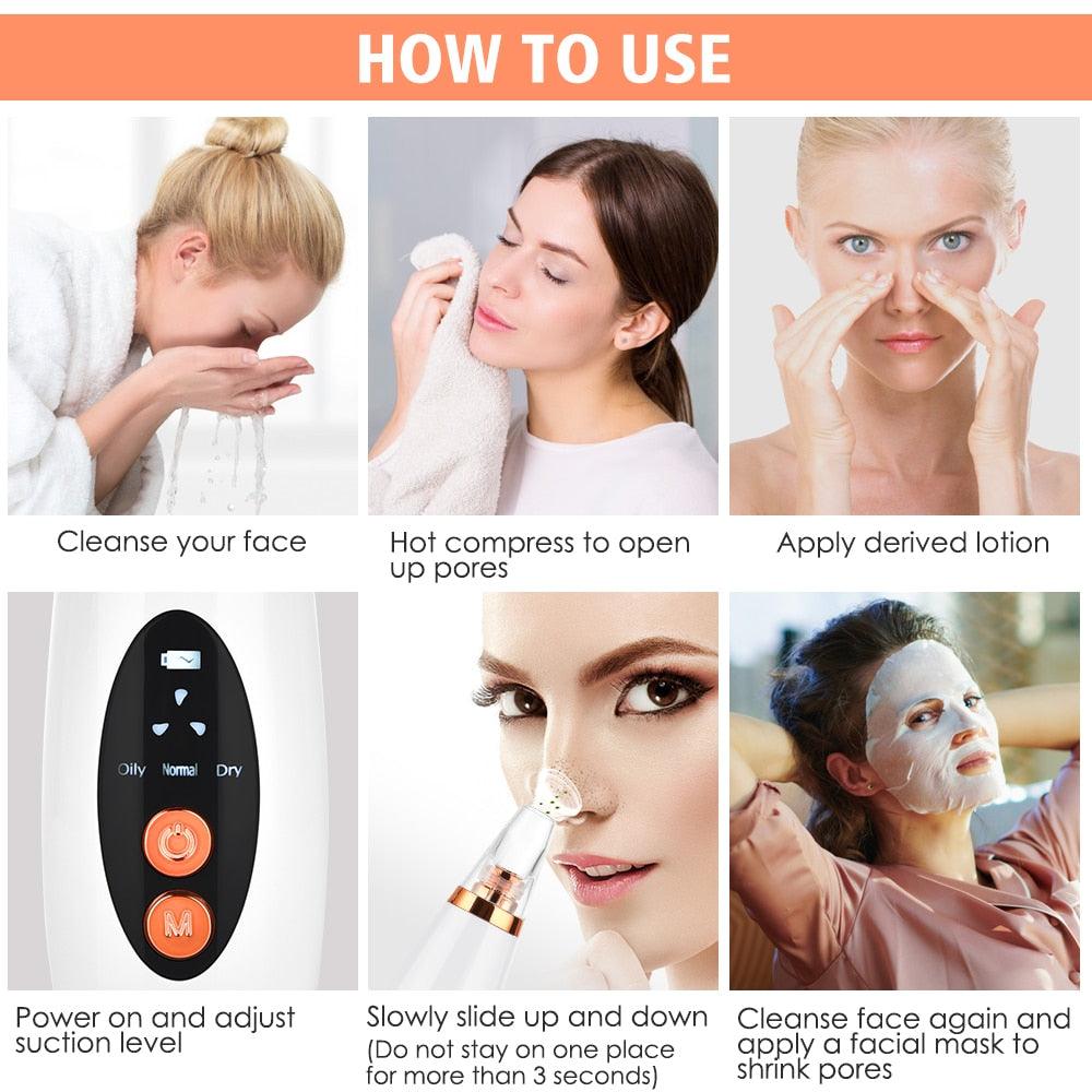 Facial Pore Cleaner Blackhead Remover Vacuum Suction Cleaner Pore Acne Pimple Extractor Device (M5)(1U86)