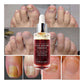 Nail Repair Essence Serum Care Treatment Foot Nail Fungus Removal Gel Anti Infection (N6)(1U85)