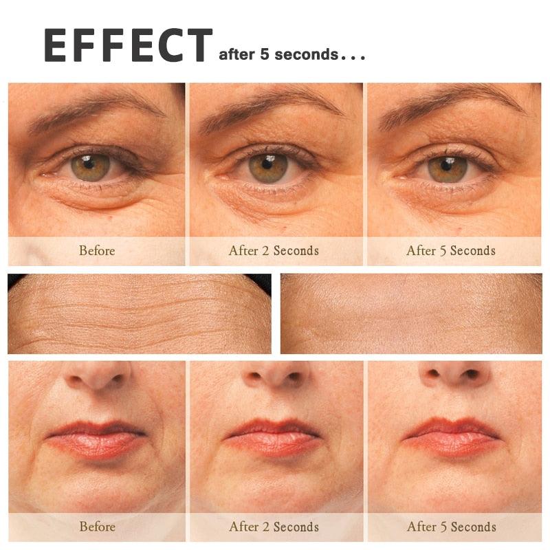 Magic Anti-Wrinkle Cream 5 Seconds Winkle Remover Lifting Facial Cream Hyaluronic Acid Cream (M1)(1U86)(F86)