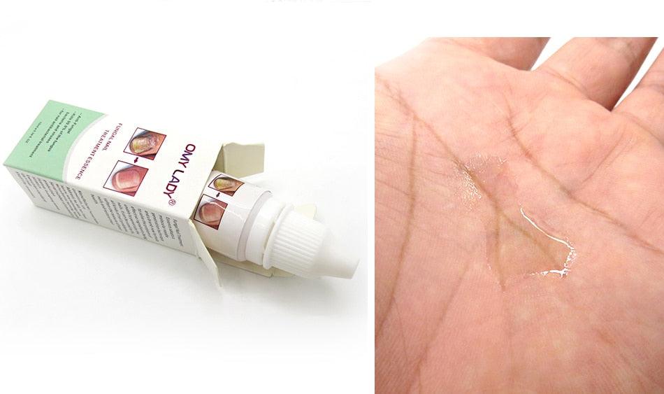 High Quality Nail Protector Skin Care ESSENCE Cream Nail Fungus Treatment Nails Repairing Cream Nail Care Tools (N6)(1U85)