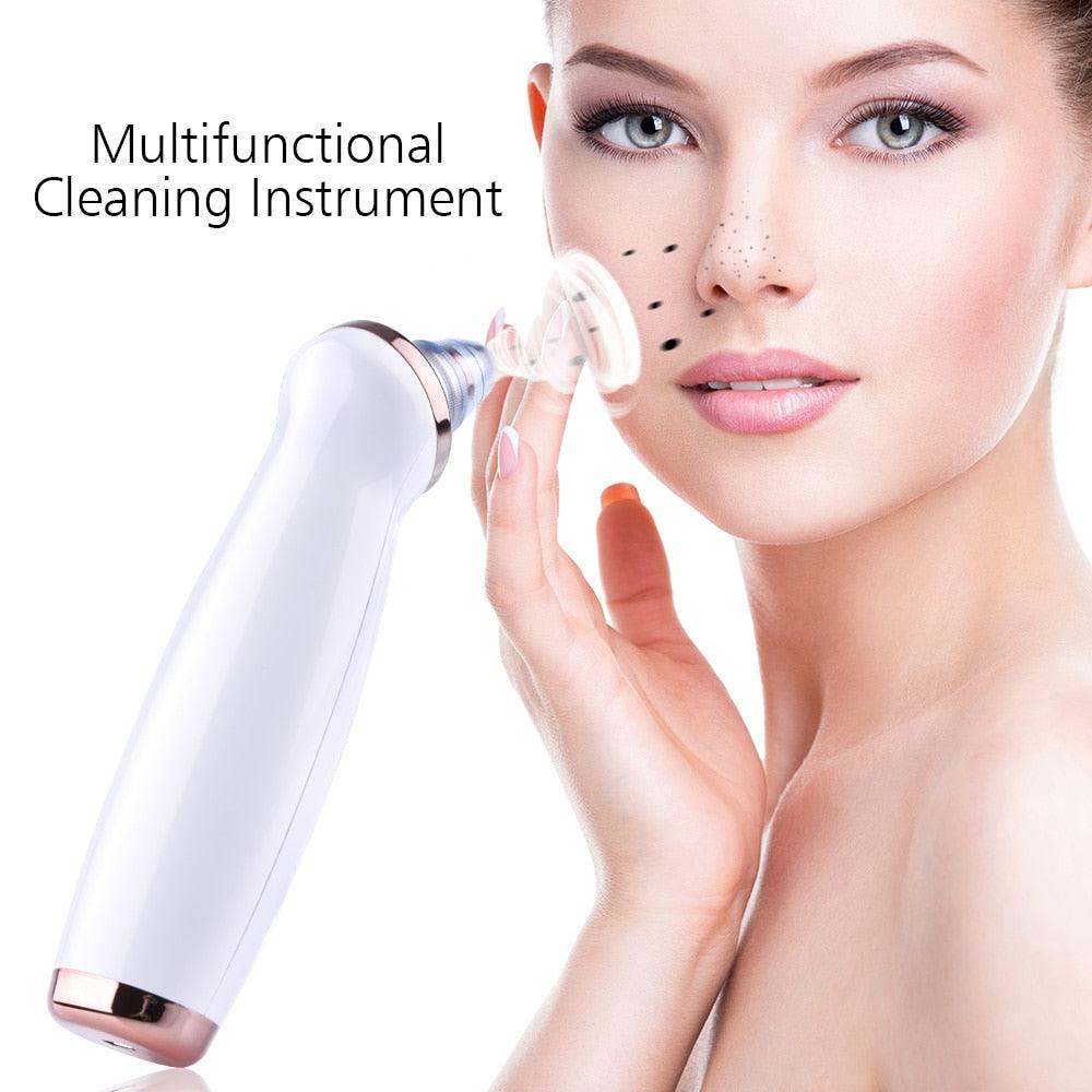 Pore Vacuum Blackhead Remover Suction Acne Peeling Pore Face Cleanser Facial Skin Care (M5)(1U86)