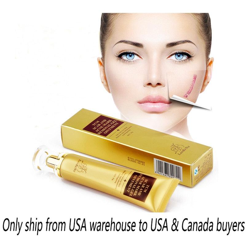 Stretch Marks Remove Acne Scar Treatment Whitening Cream Pimple Scar Pregnancy Nourish Skin Care (M1)(1U86)